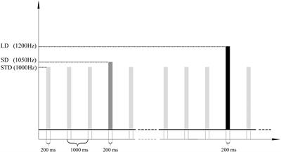 Combined Behavioral and Mismatch Negativity Evidence for the Effects of Long-Lasting High-Definition tDCS in Disorders of Consciousness: A Pilot Study